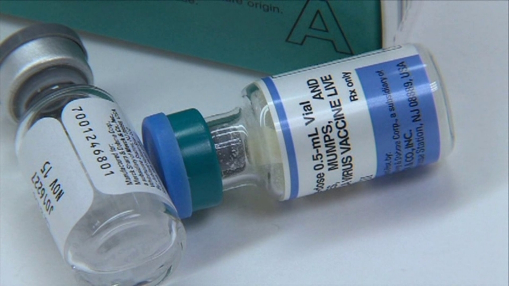 Mumps Cases In NWA Now Up To 135 Case Confirmed In Huntsville