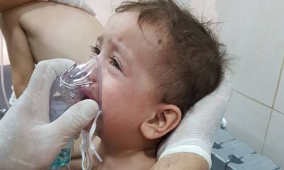 Children Among Victims Of Suspected Chlorine Gas Attack In Aleppo