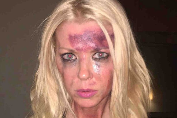 Tara Reid shocks fans in Instagram post looking bruised for anti-bullying film Worthless