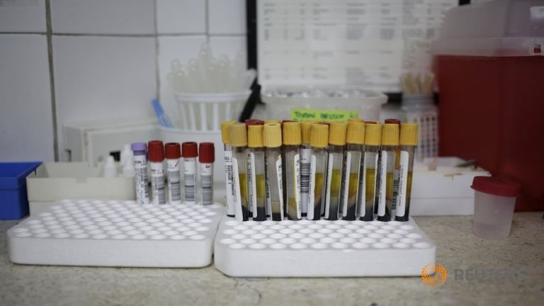 Test tubes with blood samples from patients who could possibly be infected with Zika are seen in a lab desk in Caracas