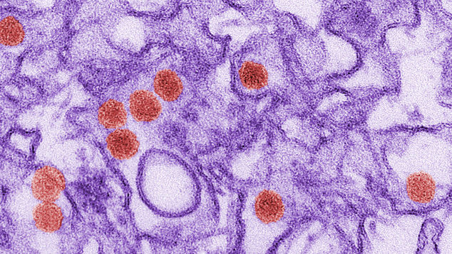 The Zika virus can affect pregnancy