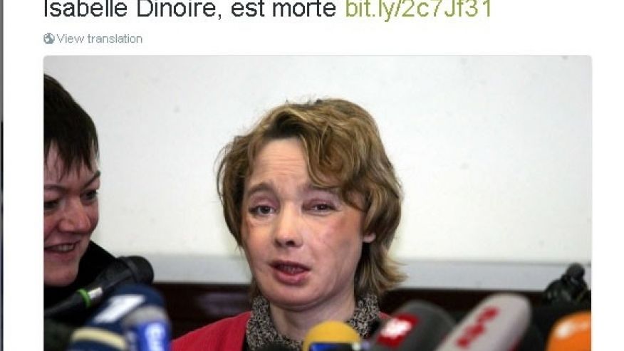 Frenchwoman who became first face transplant patient dies aged 49