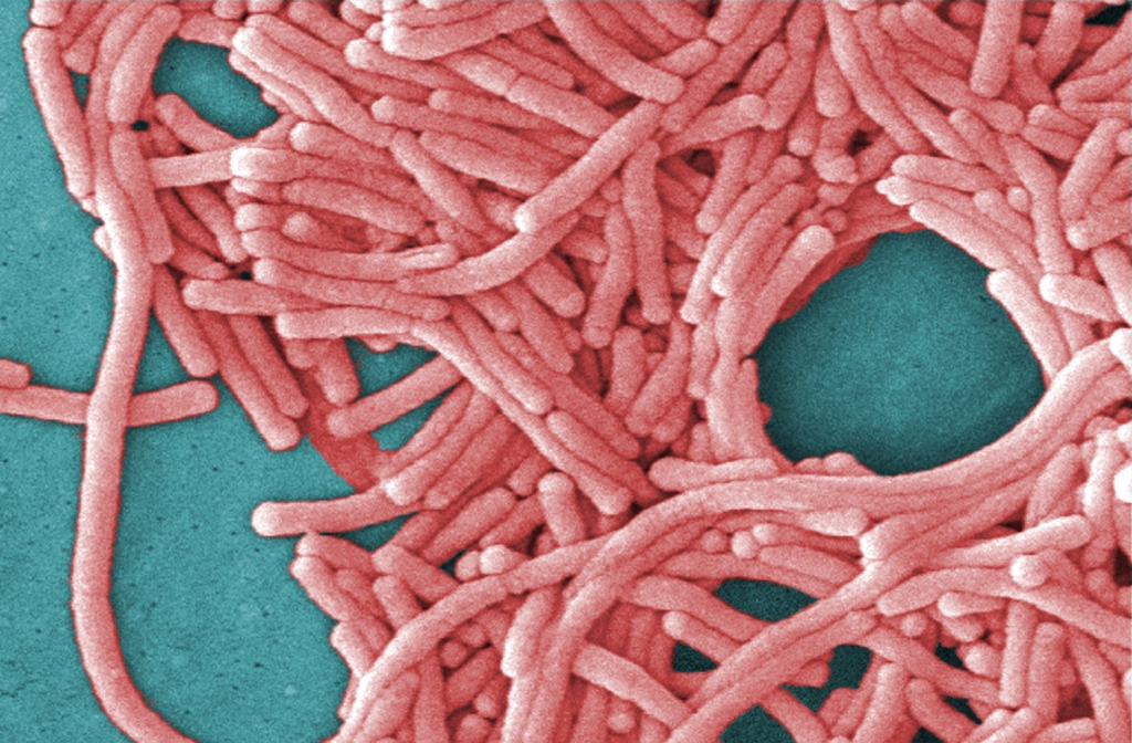 This undated image made available by the Centers for Disease Control and Prevention shows a large grouping of Legionella pneumophila bacteria. Most deaths from Legionnaires disease are tied to hospital and nursing home showers