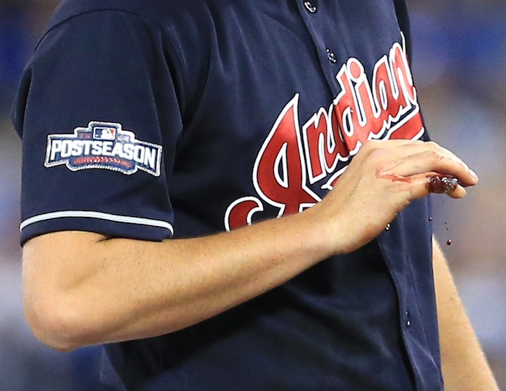 Starter Trevor Bauer's Hand Explodes on Mound in First Inning Indians Win Anyway