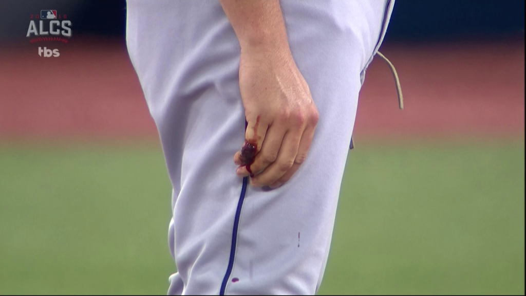 Trevor Bauer bleeding finger ALCS