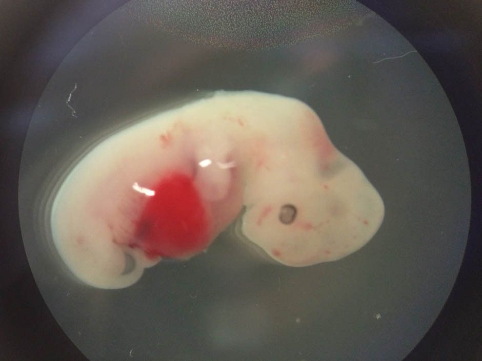 A 4-week-old pig embryo that was injected with human stem cells. The experiment was a very early step toward the possibility of growing human organs inside animals for transplantation