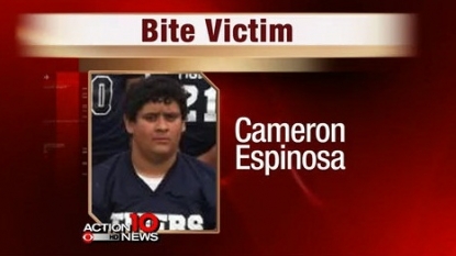 “Ant bite” kills middle school football player during a game