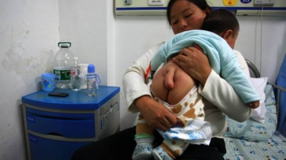 Mother urged doctors to perform surgery on her son growing ‘tail’