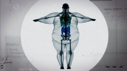 MRI scan image of a fat man gone viral on twitter