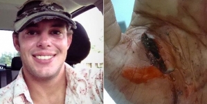 Man got bitten by an alligator after his attempt of moving the reptile from the road