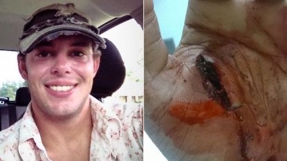 Man got bitten by an alligator after his attempt of moving the reptile from the road