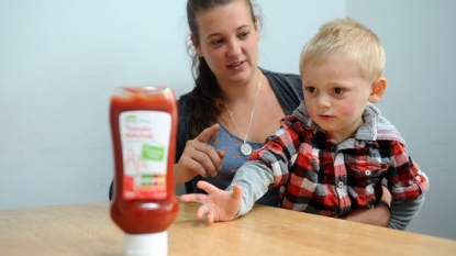 Boy aged two was nearly died after he dipped his finger in tomato ketchup