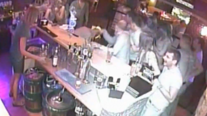 Man left horrified after a bartender burned his face accidentally