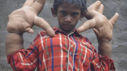 A boy got dismissed from the school because of his ‘large’ hands