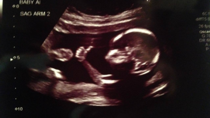 Amazing pictures – unborn gives thumbs up from mother’s womb