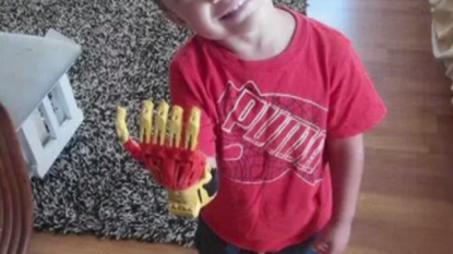 Boy who born with no fingers got a prosthetic hand for free