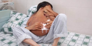 Doctors removed the world’s largest facial tumor from a Chinese man