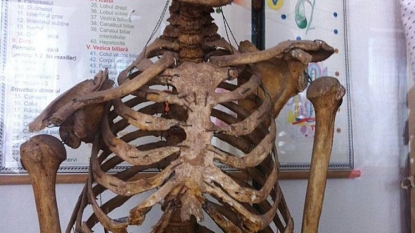 Former head teacher’s skeleton is allowed to hang in biology classroom