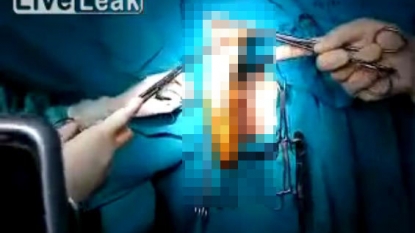 Guy was taken to hospital after girlfriend’s strap-on got accidentally stuck into his bum