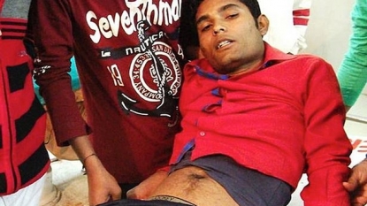 Man left in pain after an iron rod got stuck in his bum