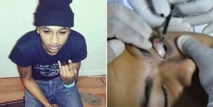 Man was hospitalized after tattooing in eye ball went wrong