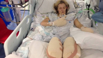 Mum has her leg and finger amputated after suffering pneumonia in last Christmas