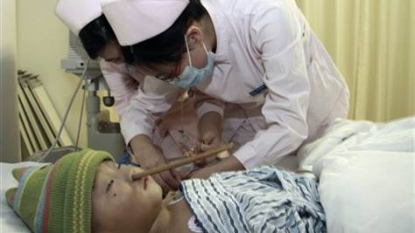 Two year old survived miraculously after a chopstick pierced into his brain