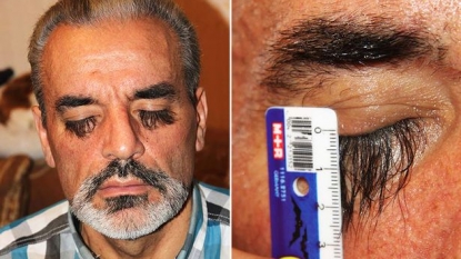 Man has long eyelashes and this all he achieved by a secret diet