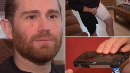 Man left with third degree burn after his iPhone exploded into his pocket