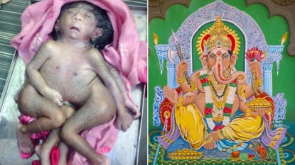 Baby born with eight limbs being worshiped by Indian people