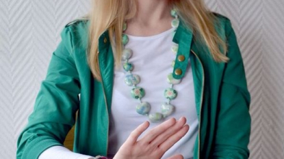 Woman has an phobia of cheese and she can’t even watch it