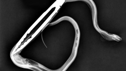 Pet python undergone a surgery after swallowing a ‘barbecue tongs’