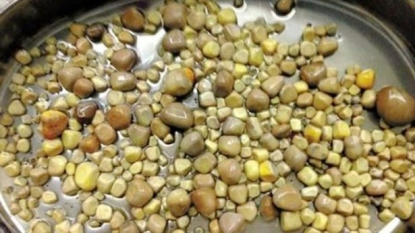 Man has 420 kidney stones removed in an lifesaving operation