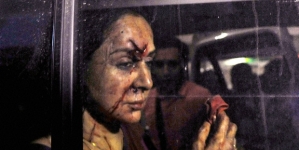 Bollywood News: Hema Malini Injured In A Road Accident