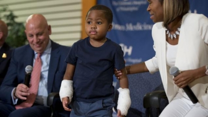 Boy, 8, is youngest patient to undergo double-hand transplant