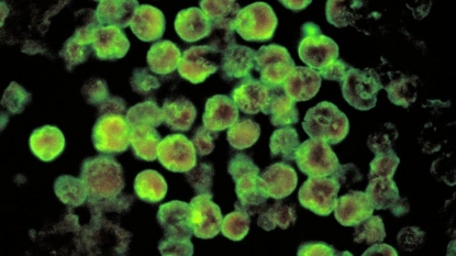 Brain eating amoeba found in drinking water