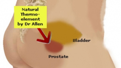 Expectant management of very low-, low-risk prostate cancer is effective, but