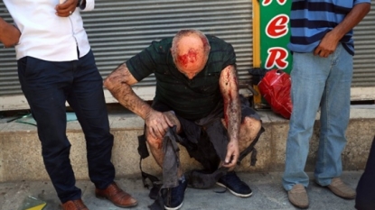 Explosion Kills 28 in Turkey