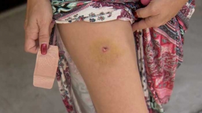 After days of pain, Fla. woman finds she was hit with bullet