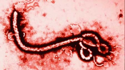 Liberia registers 2nd confirmed Ebola case