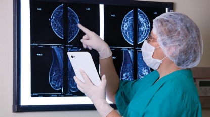 Mammograms don’t reduce breast-cancer deaths?