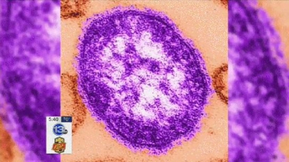 Measles Kills First Patient In 12 Years – WETM