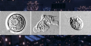 Brain-Eating Amoeba Kills 21-Year-Old California Woman: Health Officials | KTLA