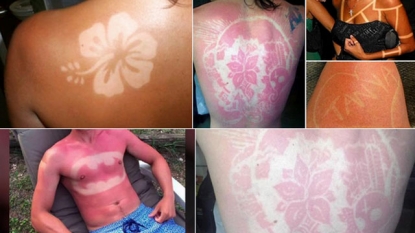 Sunburn art – CHCH – Your Superstation