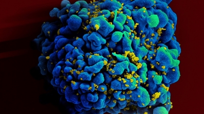 Teen Manages To Stave Off HIV Without Drugs For A Decade