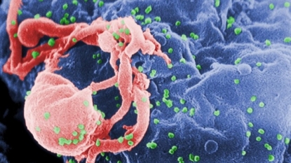 Teen in remission from HIV 12 years after stopping meds