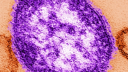 US announces first death from measles in 12 years | theSundaily