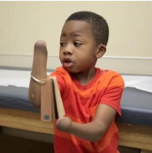 Boy Makes History With Double-Hand Transplant