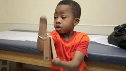 Boy Makes History With Double-Hand Transplant