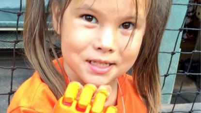 Girl throws out first pitch with robotic hand